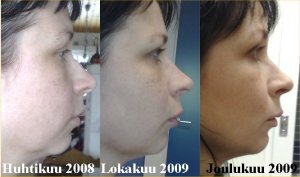 profiilikooste-joulukuu-2009-v2